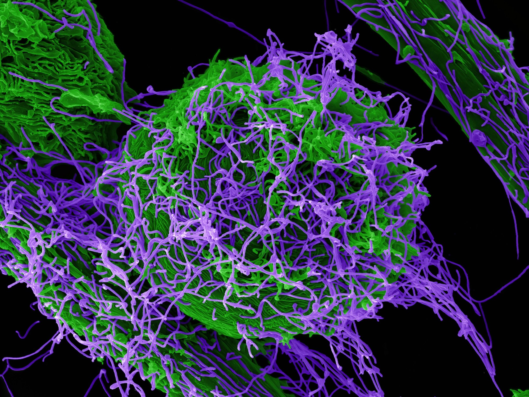 Photo of Ebola Virus Particles by National Institute of Allergy and Infectious Diseases on Unsplash