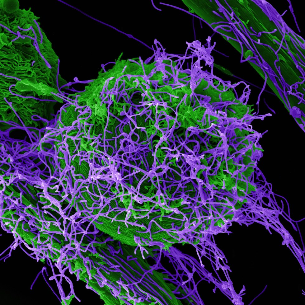 Photo of Ebola Virus Particles by National Institute of Allergy and Infectious Diseases on Unsplash